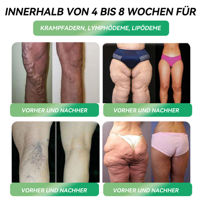 𝐇𝗛𝑉𝖡® 👩‍⚕️𝐆𝗟𝑷-1 𝐒𝐄𝐂𝐇𝐒 𝐈𝐍 𝐄𝐈𝐍𝐄𝐌 𝐆𝐞𝐬𝐮𝐧𝐝𝐡𝐞𝐢𝐭𝐬𝐥ö𝐬𝐮𝐧𝐠👩‍⚕️ 𝐟𝐥ü𝐬𝐬𝐢𝐠 𝐳𝐮𝐦 𝐄𝐢𝐧𝐧𝐞𝐡𝐦𝐞𝐧 (Nur eine Dosis pro Tag, sichtbare Veränderungen in 7 Tagen) ✅ Für Fettleibigkeit, kardiovaskuläre Gesundheit, Diabetes, Schlafapnoe, Gelenkprobleme und mehr.